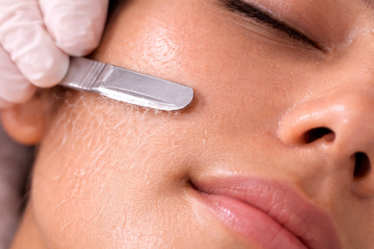 Dermaplaning Facial